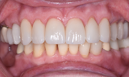 Cosmetic-After