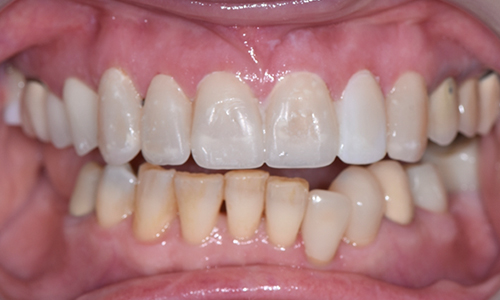 Cosmetic-Before