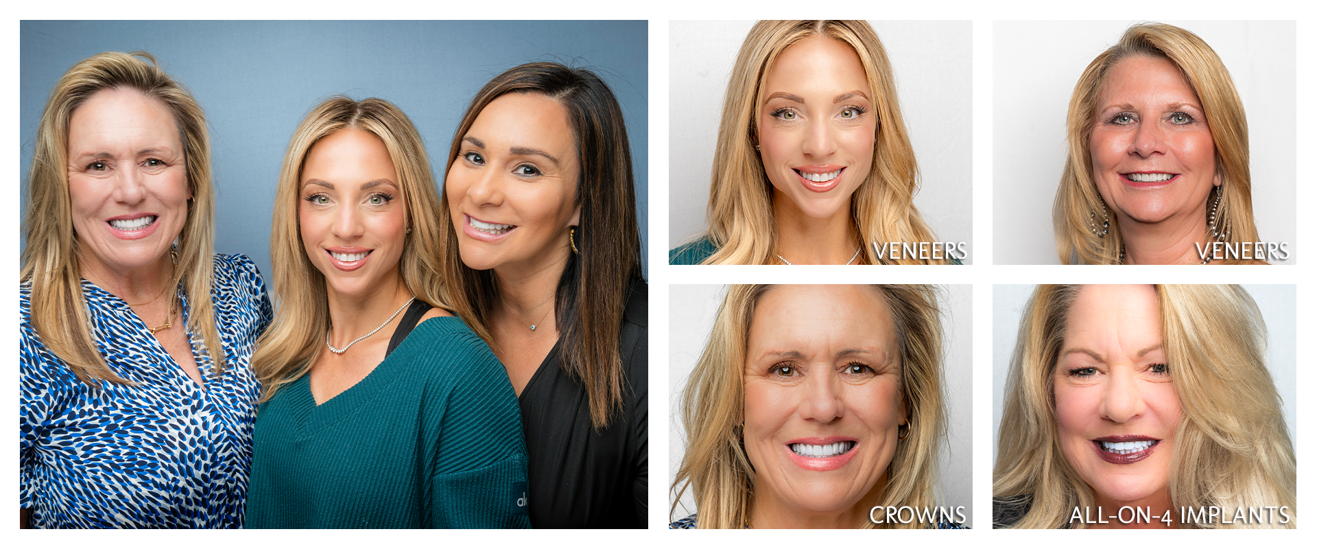 Smile Makeovers